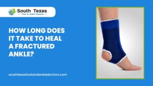 How Long Does It Take to Heal a Fractured Ankle