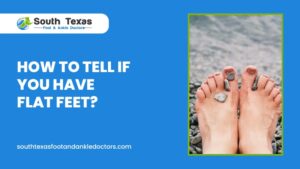 How to Tell If You Have Flat Feet
